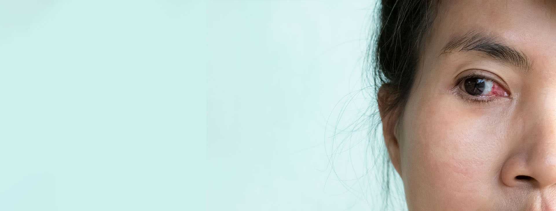 Oculoplastics in Las Vegas Oculoplastics Las Vegas